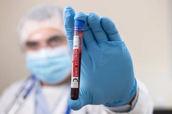Гепатит B — татуаж в Днепре, 3 случая и риск вакцинации, 19 мая 2026. Новини Дніпра